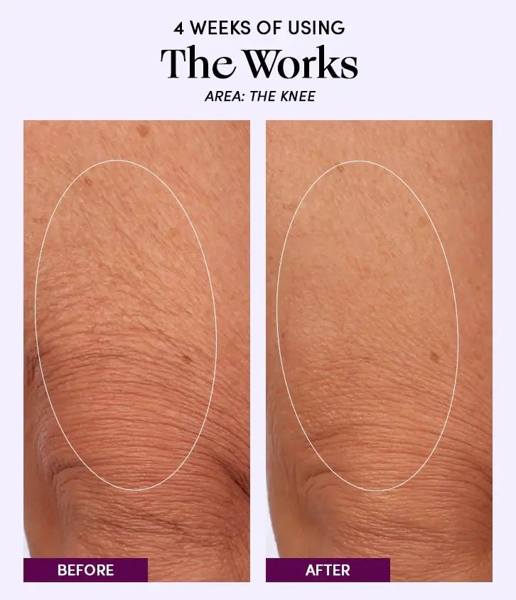 Before and after results of using The Works All-Over Toning Body Cream